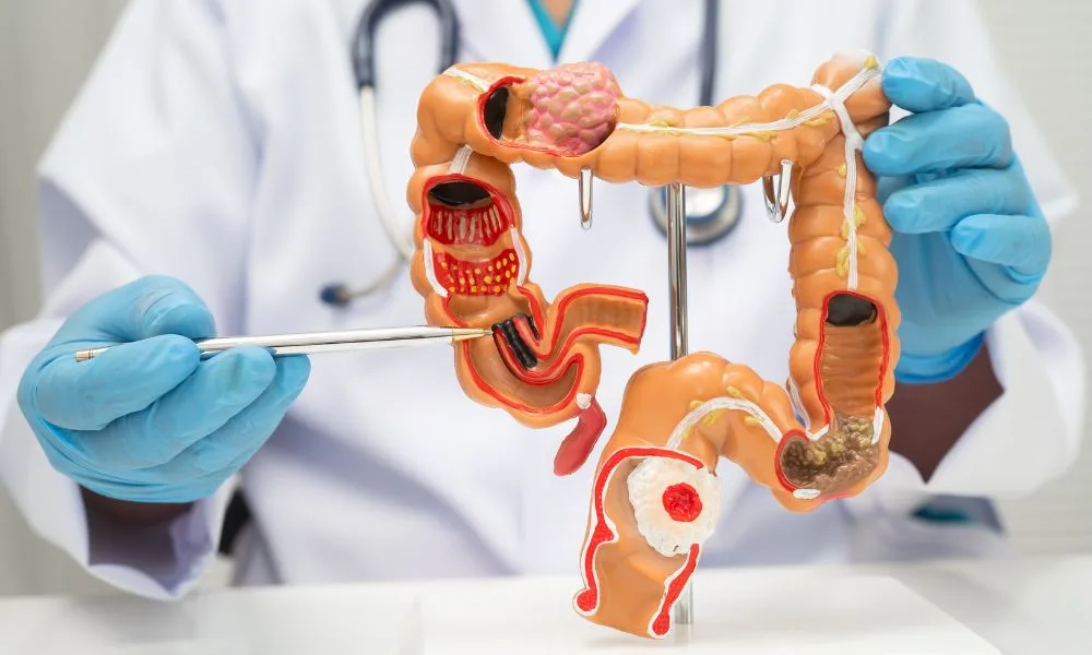 Viachole Klinicne studije jpg Κλινικές Μελέτες
